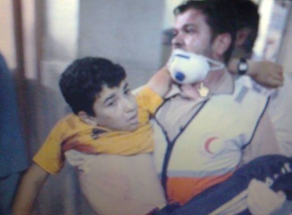تماثل للشفاء الطفل عبدالكريم الأغا الذي إستهدفته طائرات العدو